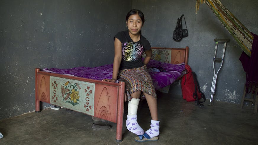 Manuela uit Guatemala met een voet in het gips