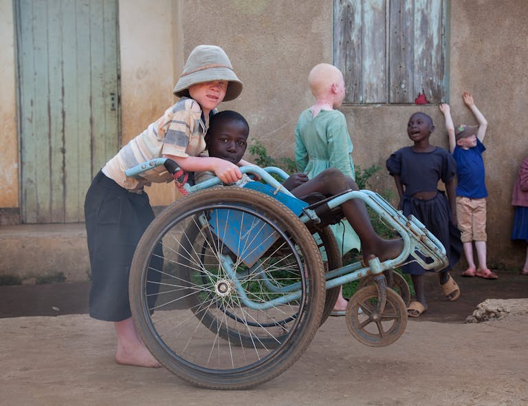 Jongen met Albinisme en vriendje in rolstoel in Tanzania