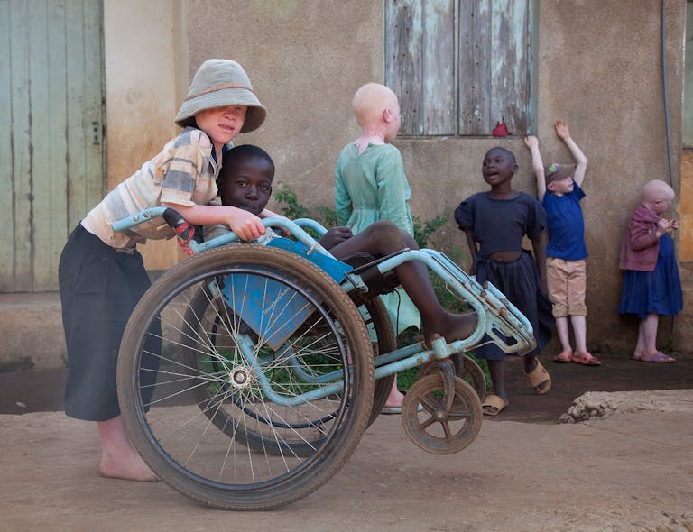 Jongen met Albinisme en vriendje in rolstoel in Tanzania