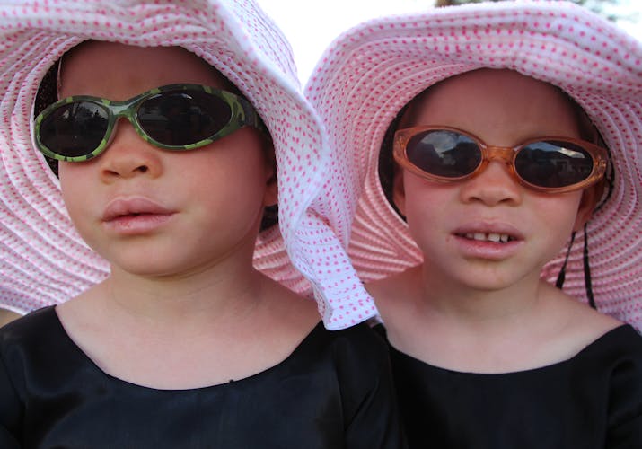 Zusjes met albinimse met hoed en zonnebril