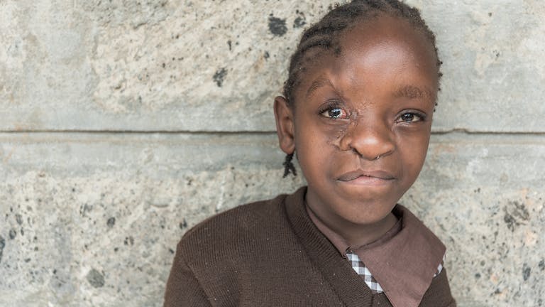 Celestine met handicap uit Kenia