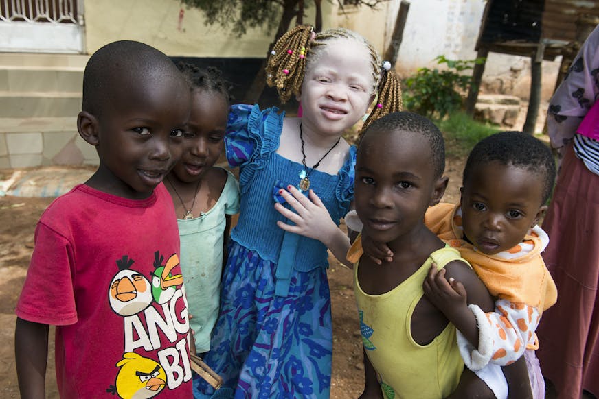 Judith met albinisme en haar vriendjes