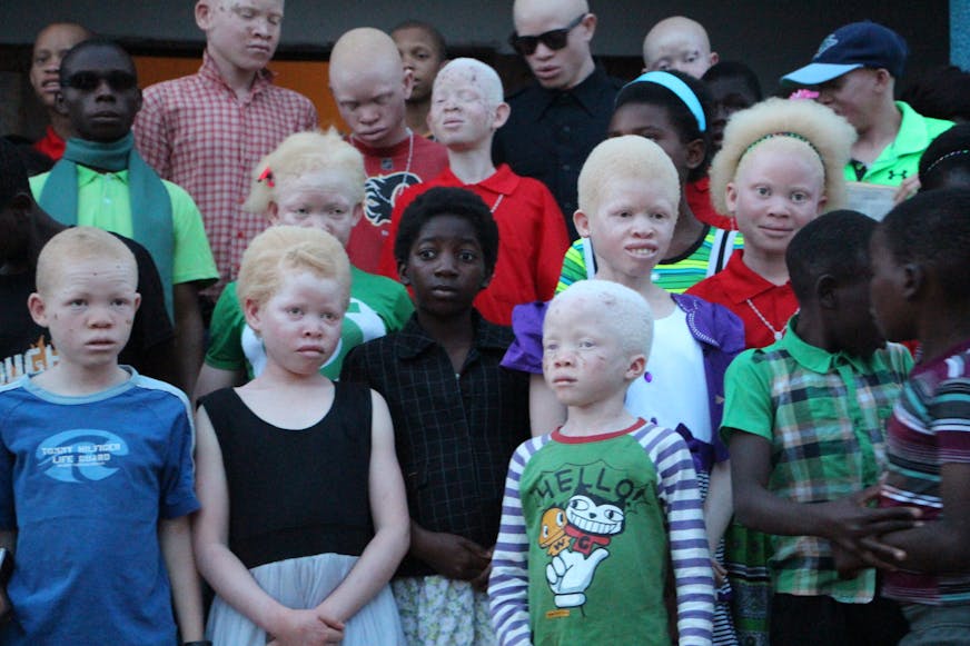 Groep kinderen met albinisme